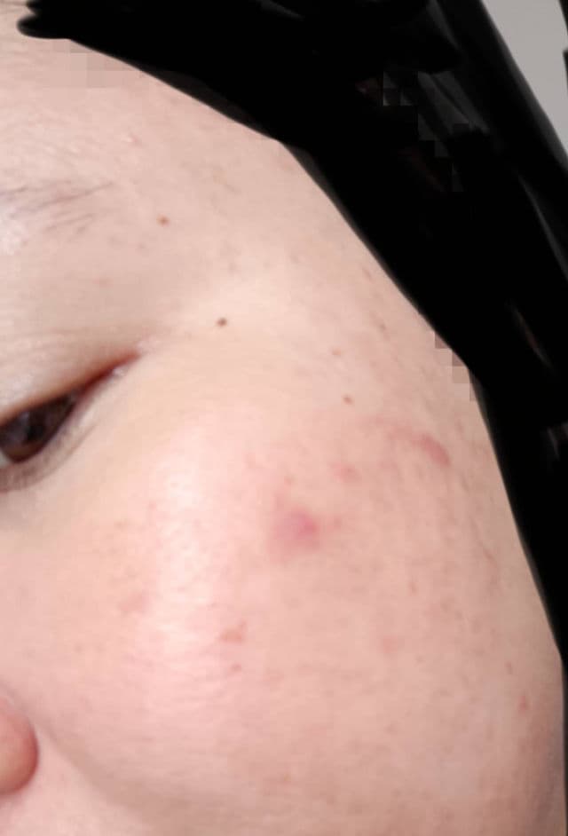 S.NATURE Aqua Squalane Serum review photo by Jamalia