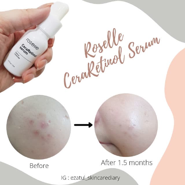 Roselle Skincare CeraRetinol Serum review photo by ezatulSkincareDiary