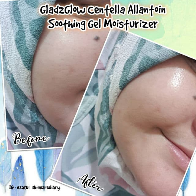 Glad2Glow Centella Allantoin Soothing Gel Moisturizer review photo by ezatulSkincareDiary