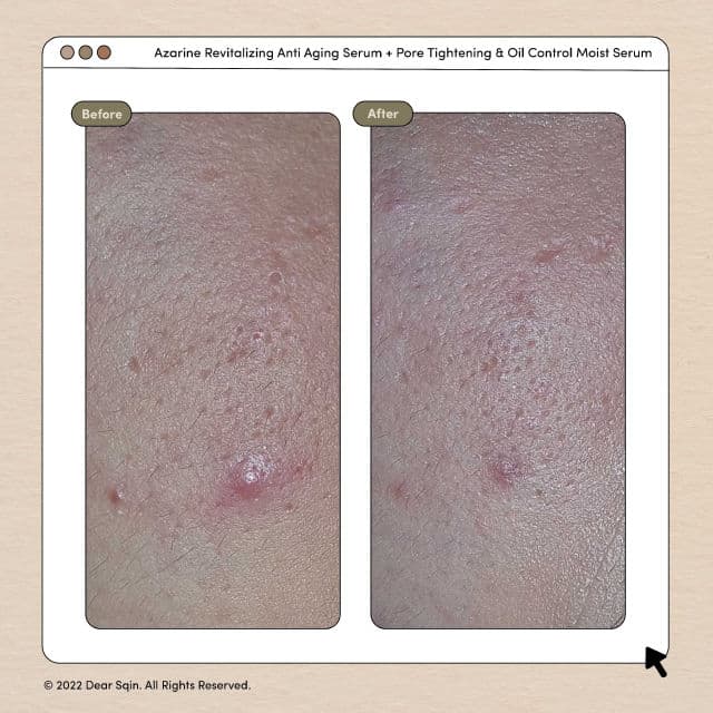 Azarine Revitalizing Anti Aging Serum review photo by dearsqin