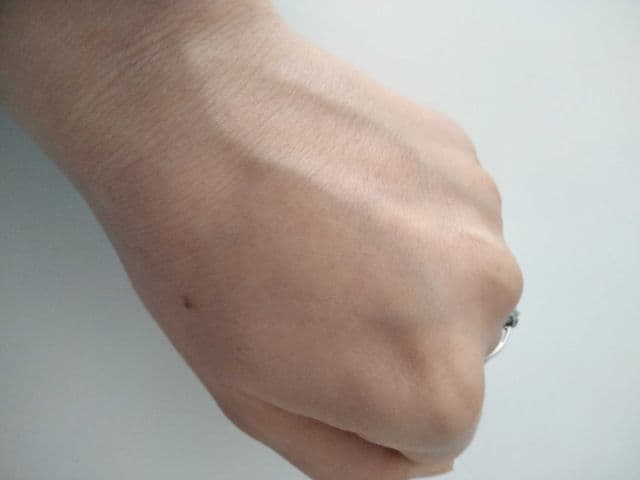 Galderma Actinica Lotion review photo by AnaGeorgiana