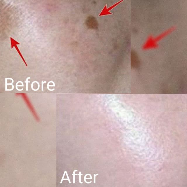 Nadinola Skin Discoloration Fade Cream Extra Strength Formula review photo by AlottaReviews