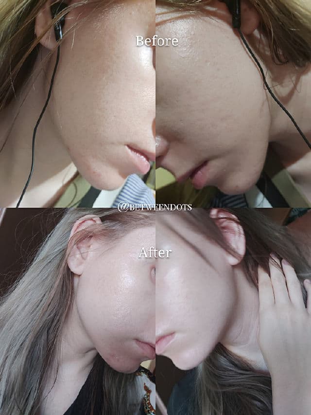 Vichy Liftactiv Glyco-C Night Peel Ampoule review photo by Betweendots