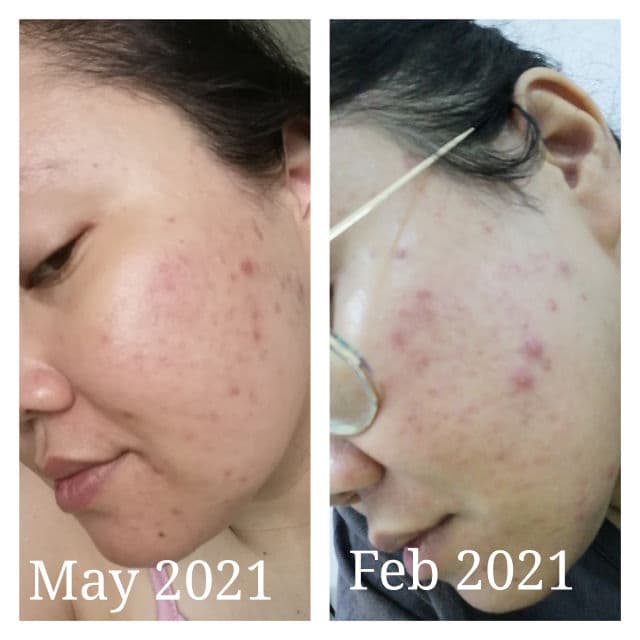 Hada Labo Blemish & Oil Control Hydrating Lotion review photo by Jamalia