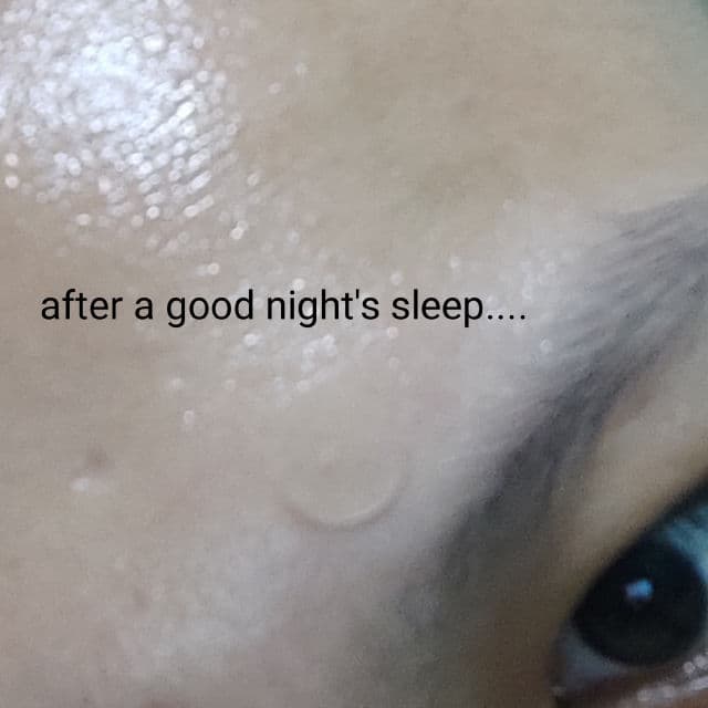 MEDIHEAL A-Zero Shot Skin Dressing Patch review photo by SkincareSushi