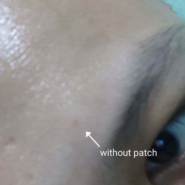 MEDIHEAL A-Zero Shot Skin Dressing Patch review photo by SkincareSushi