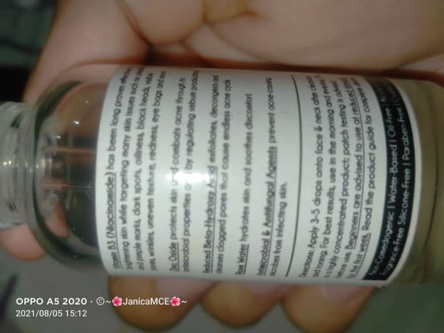 SkinABCs Niacinamide for Oily and Acne-Prone Skin Serum review photo by Skyline