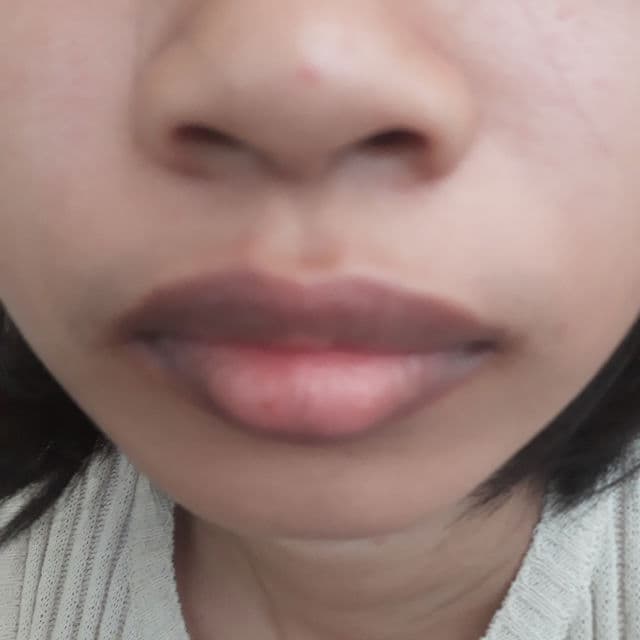 Lanbena Lsoflavone Lip Care Serum Lip Plumper review photo by Swet