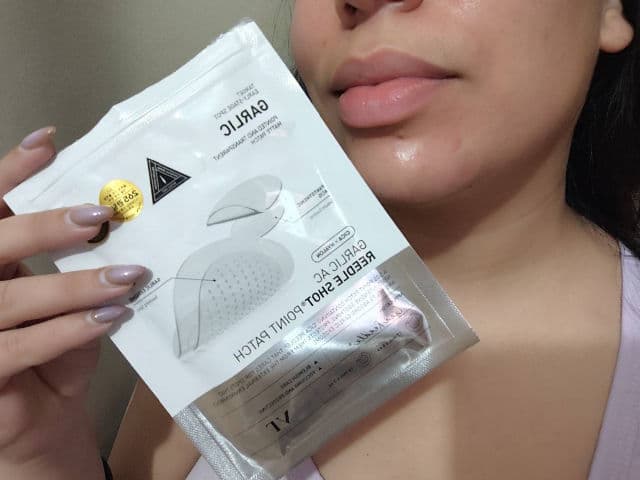 VT COSMETICS Garlic AC Reedle Shot Point Patch review photo by Paolaarismendi