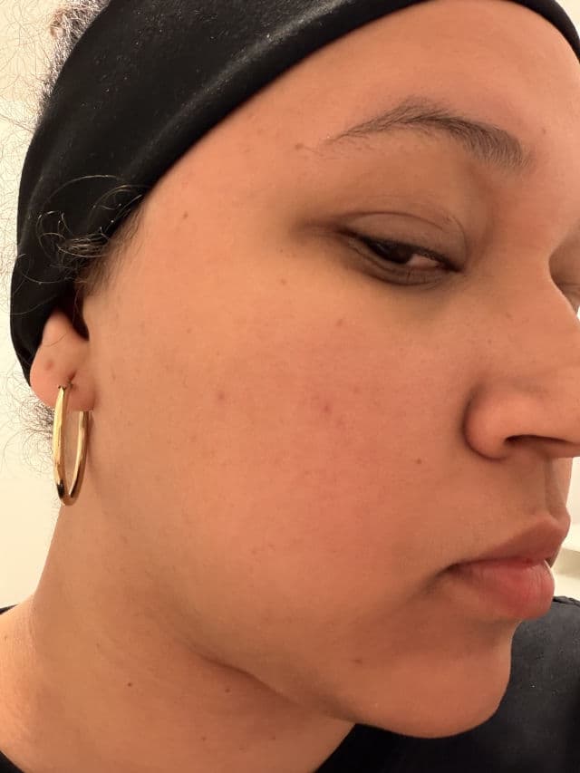 Dr. Deep Mineral Free-Peeling Glow Shot 1500 review photo by yoselaine