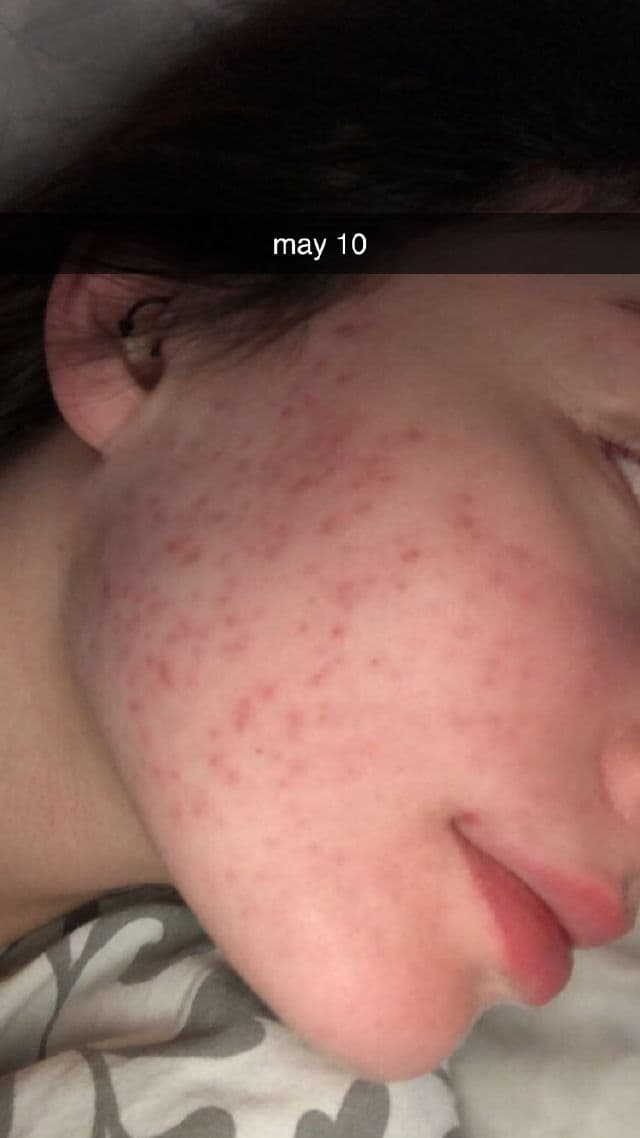 Honest Beauty Honestly Pure Retinol Serum review photo by ajada