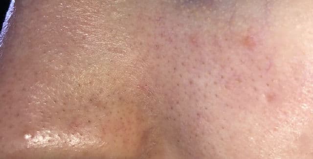 Blaq Peel Off Mask review photo by amg3268