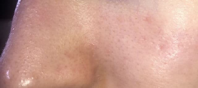 Blaq Peel Off Mask review photo by amg3268