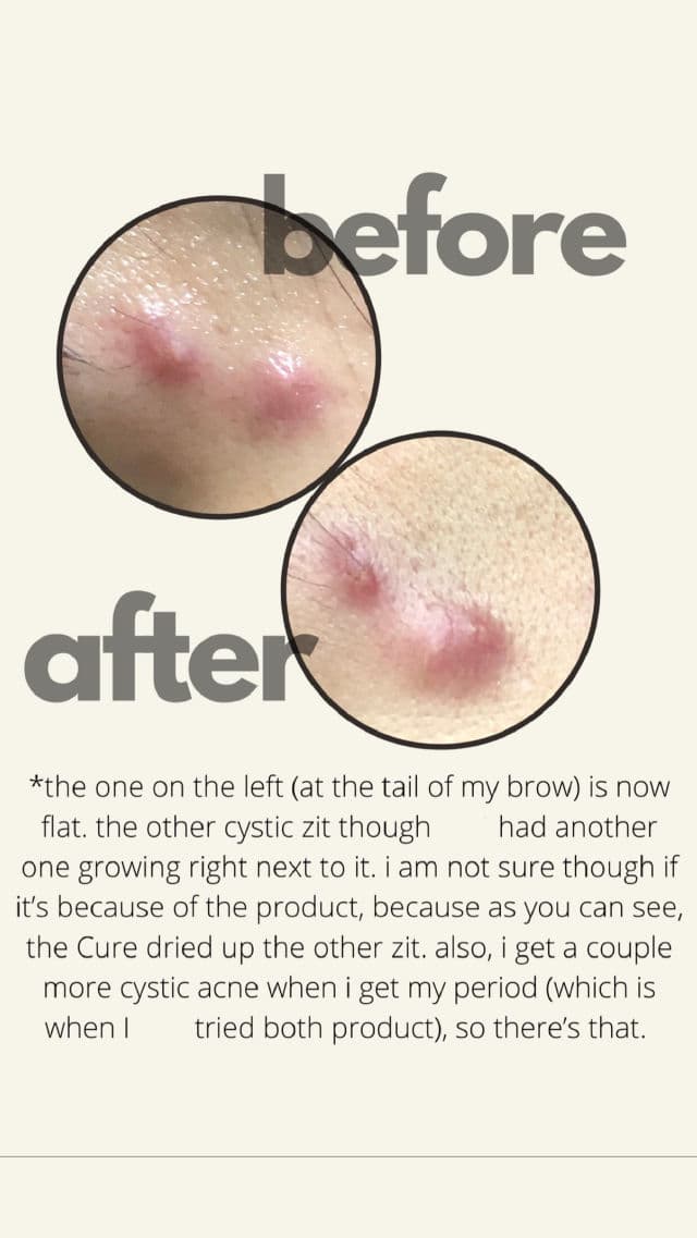 Herbal Face Food The Cure X review photo by maliaperks