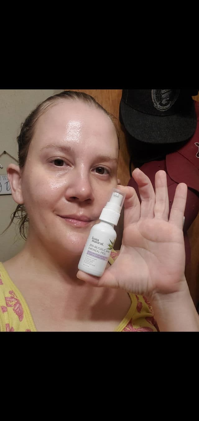 InstaNatural Glycolic Peel review photo by beautybonnebeth