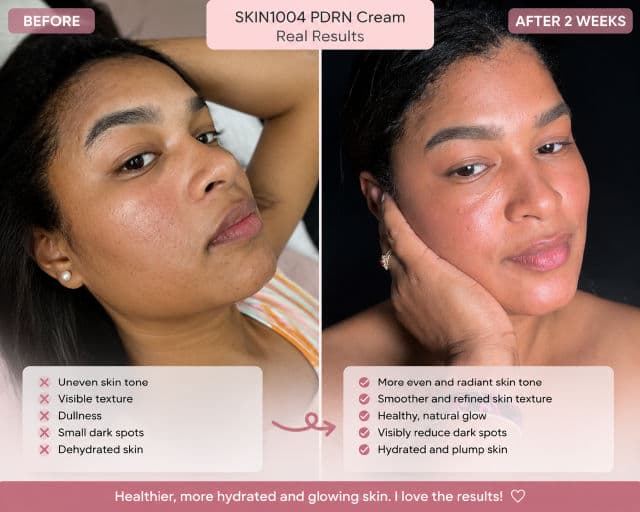 SKIN1004 Madagascar Centella PDRN 1.5 Cream review photo by DianaAquino
