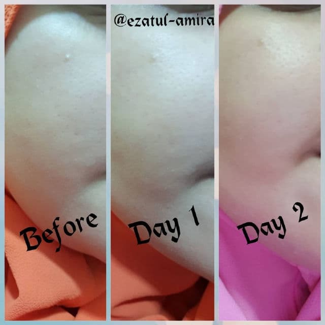 Akimia Electronica Microcurrent Sheet Mask review photo by ezatulSkincareDiary