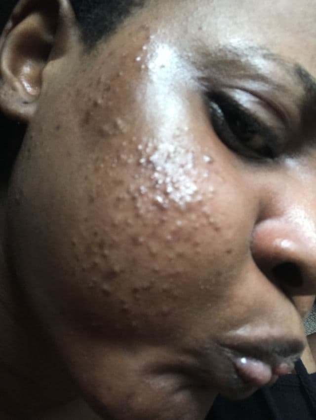 Face Facts The Glow Routine - Hyaluronic Hydra Gel Cream review photo by Ijidasiy