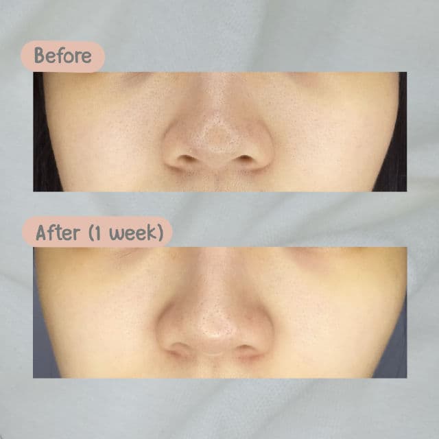 Somethinc 2% BHA Salicylic Acid Liquid Perfector review photo by jefinawong