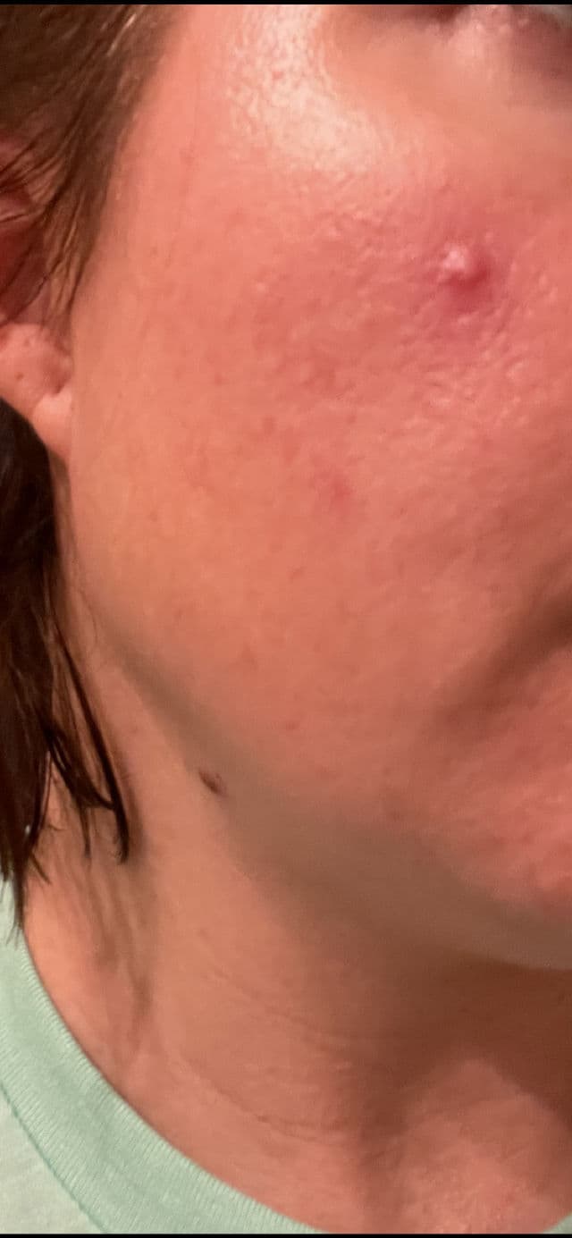 facetheory Mandelibright Serum review photo by micheleteer